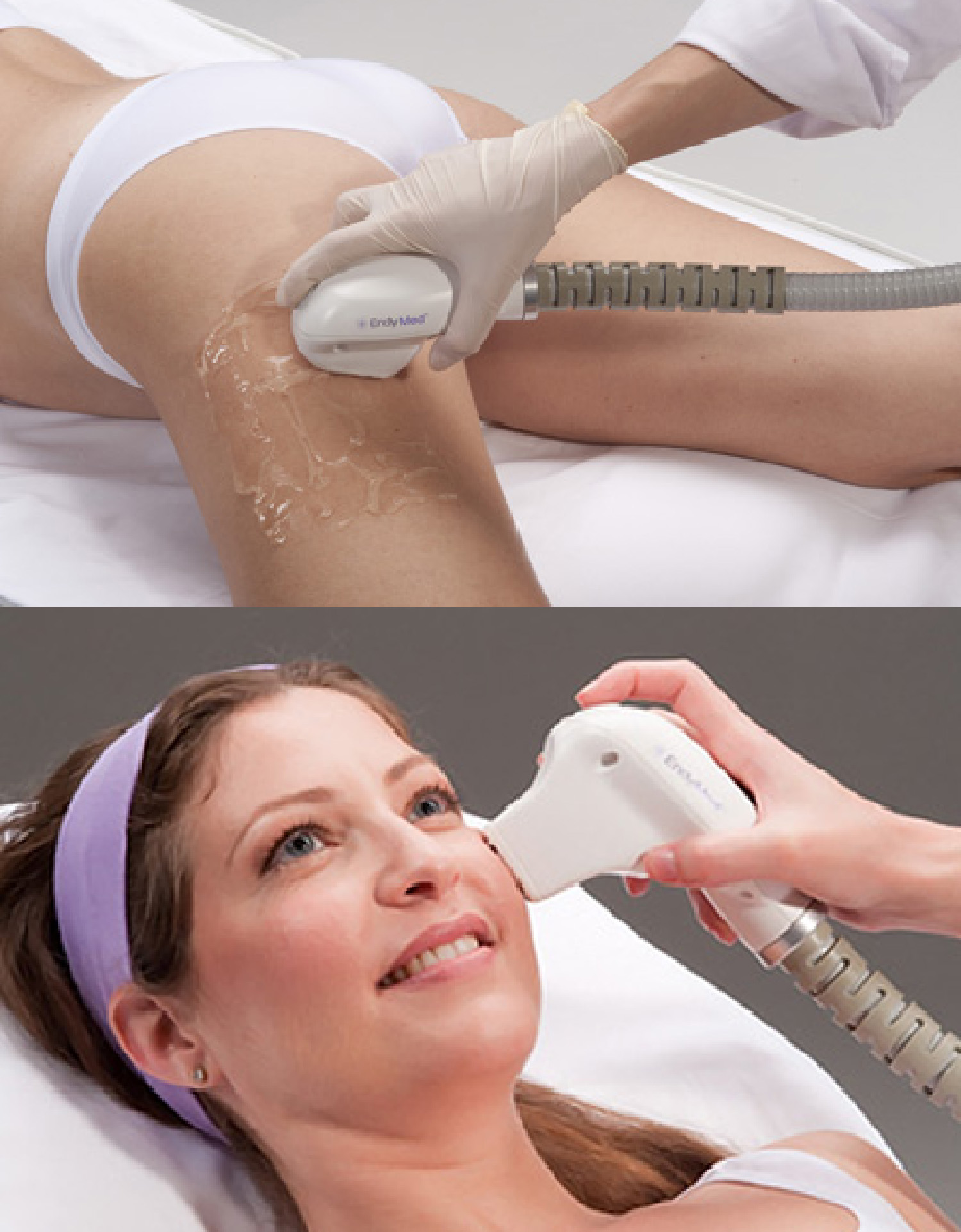 Laser scar removal Vancouver