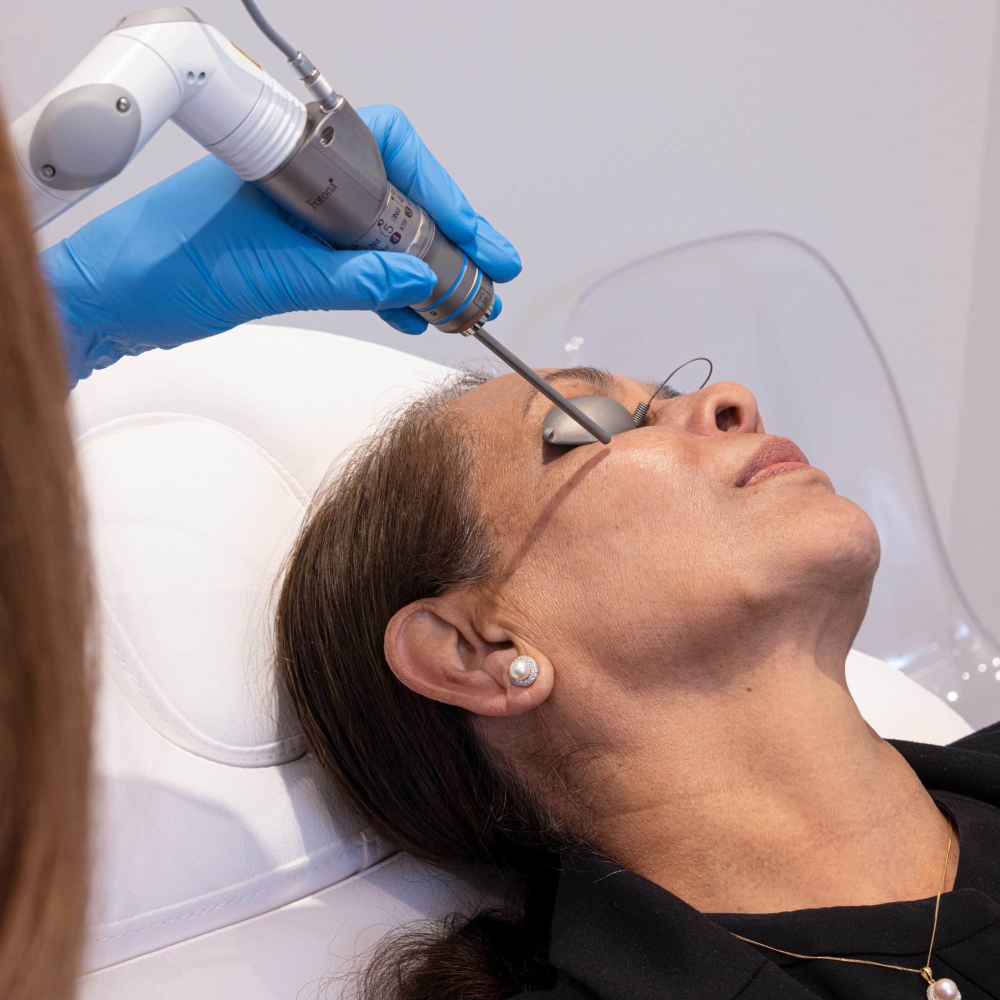 Technique for StarWalker Treatments