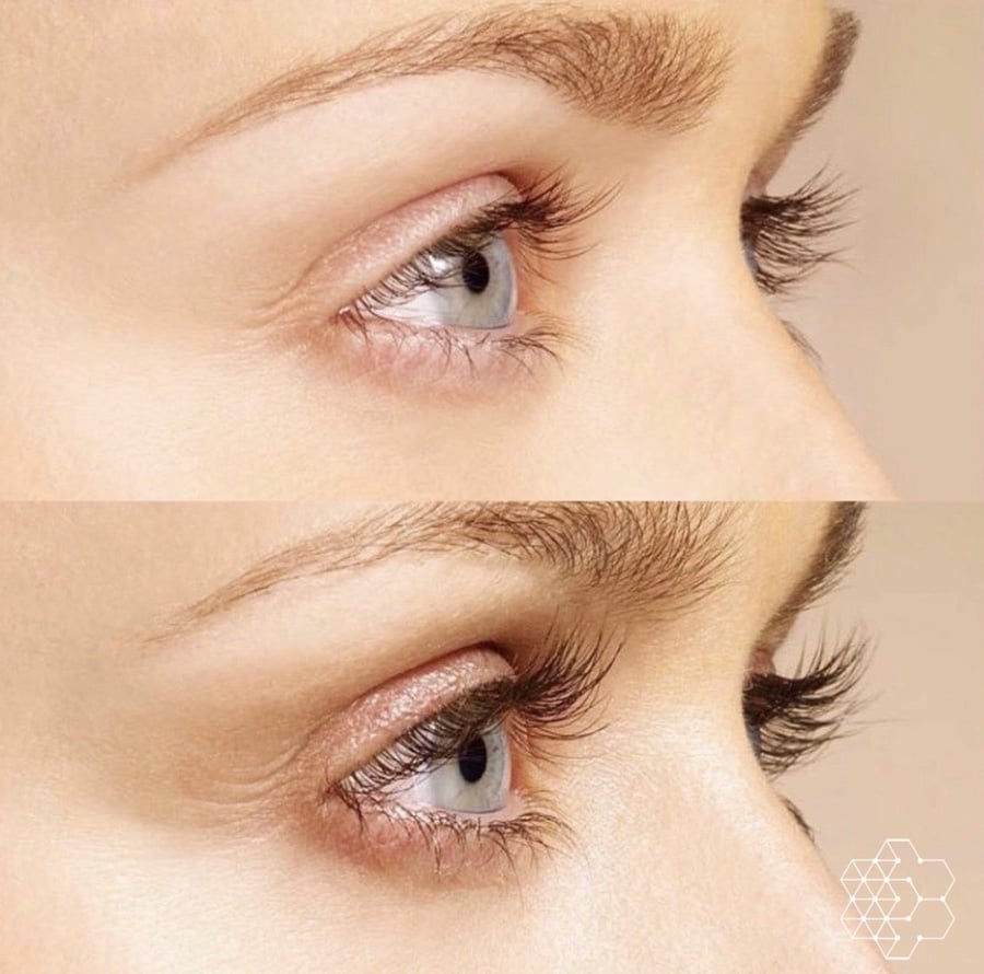 Sparse Lashes Treatment in Vancouver