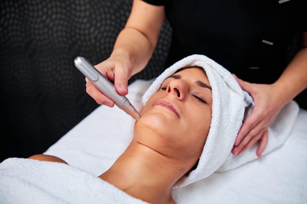 Can Microneedling Help with Acne?