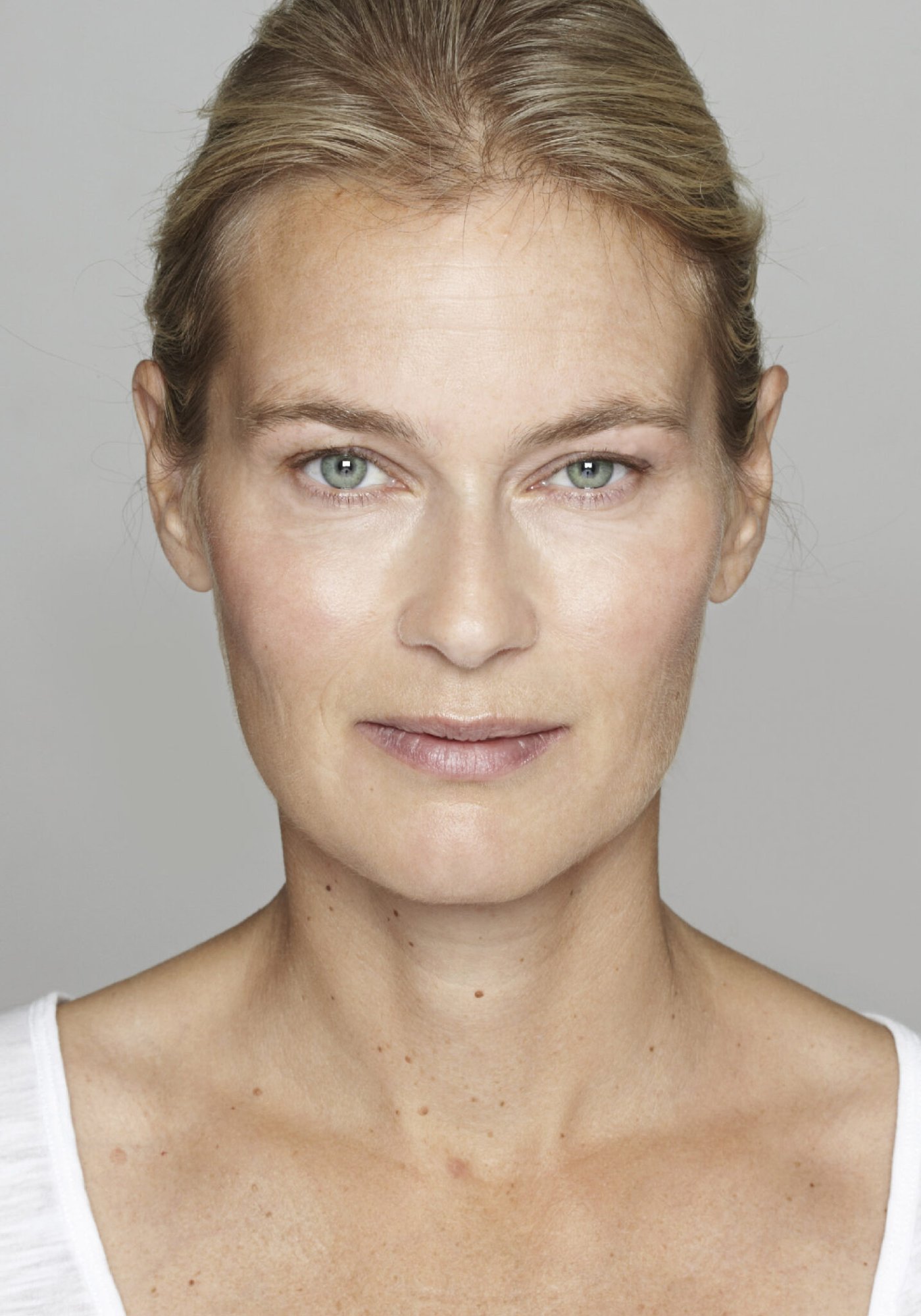 Skin Brightening After