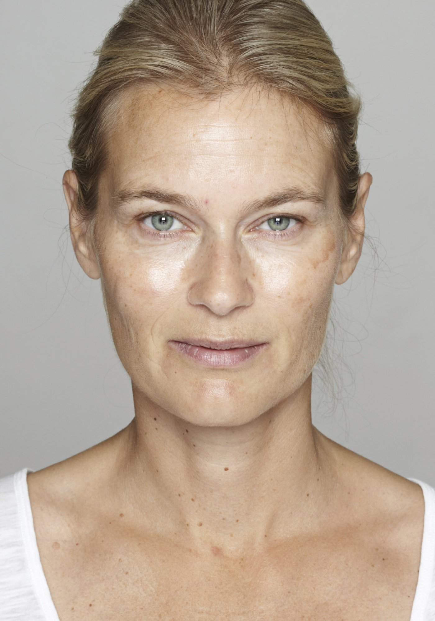 Skin Brightening Before