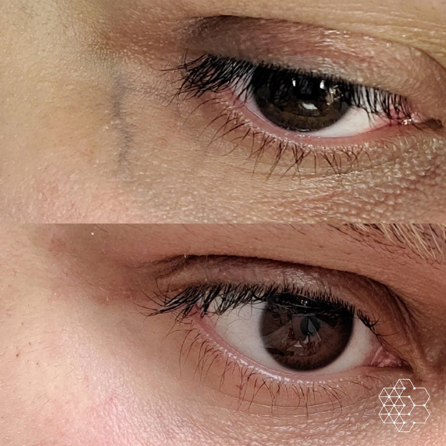 Vein Clinic Vancouver