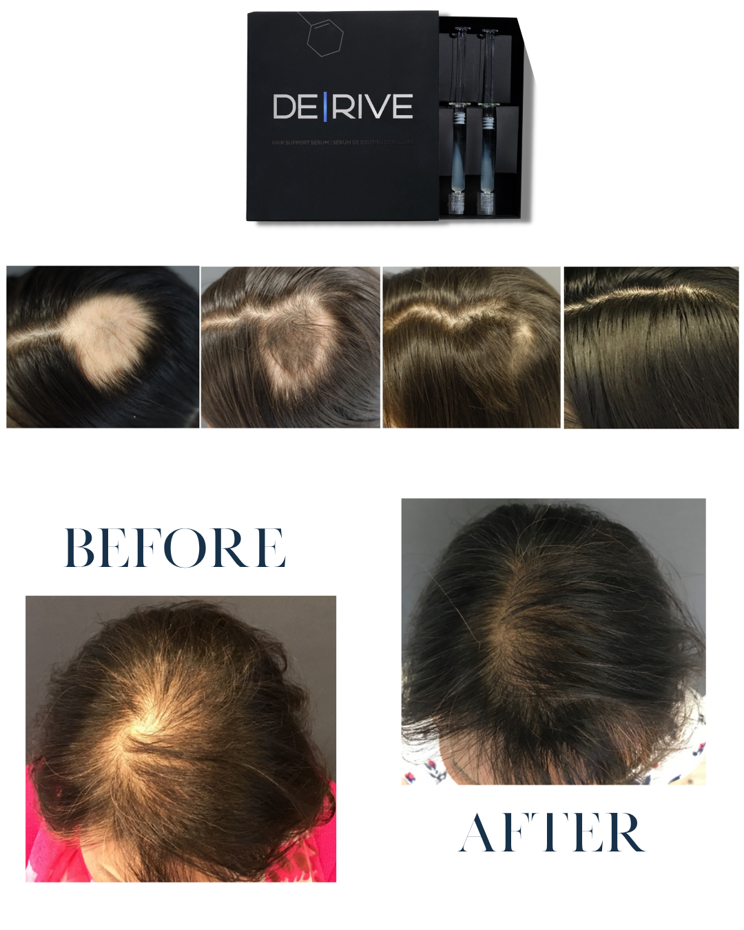 Derive Hair Treatment